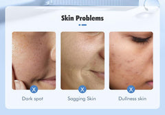 Mashata SALICYLIC ACID PORE REFINING CORRECTING SERUM