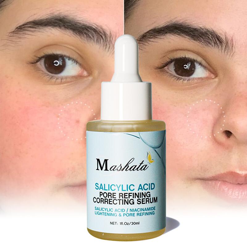 Mashata SALICYLIC ACID PORE REFINING CORRECTING SERUM