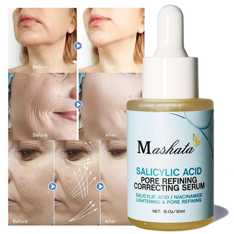 Mashata SALICYLIC ACID PORE REFINING CORRECTING SERUM